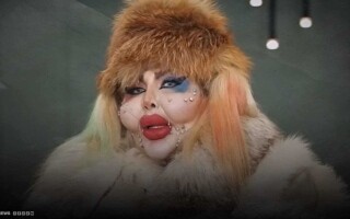 Iranian Woman Undergoes 388 Plastic Surgeries